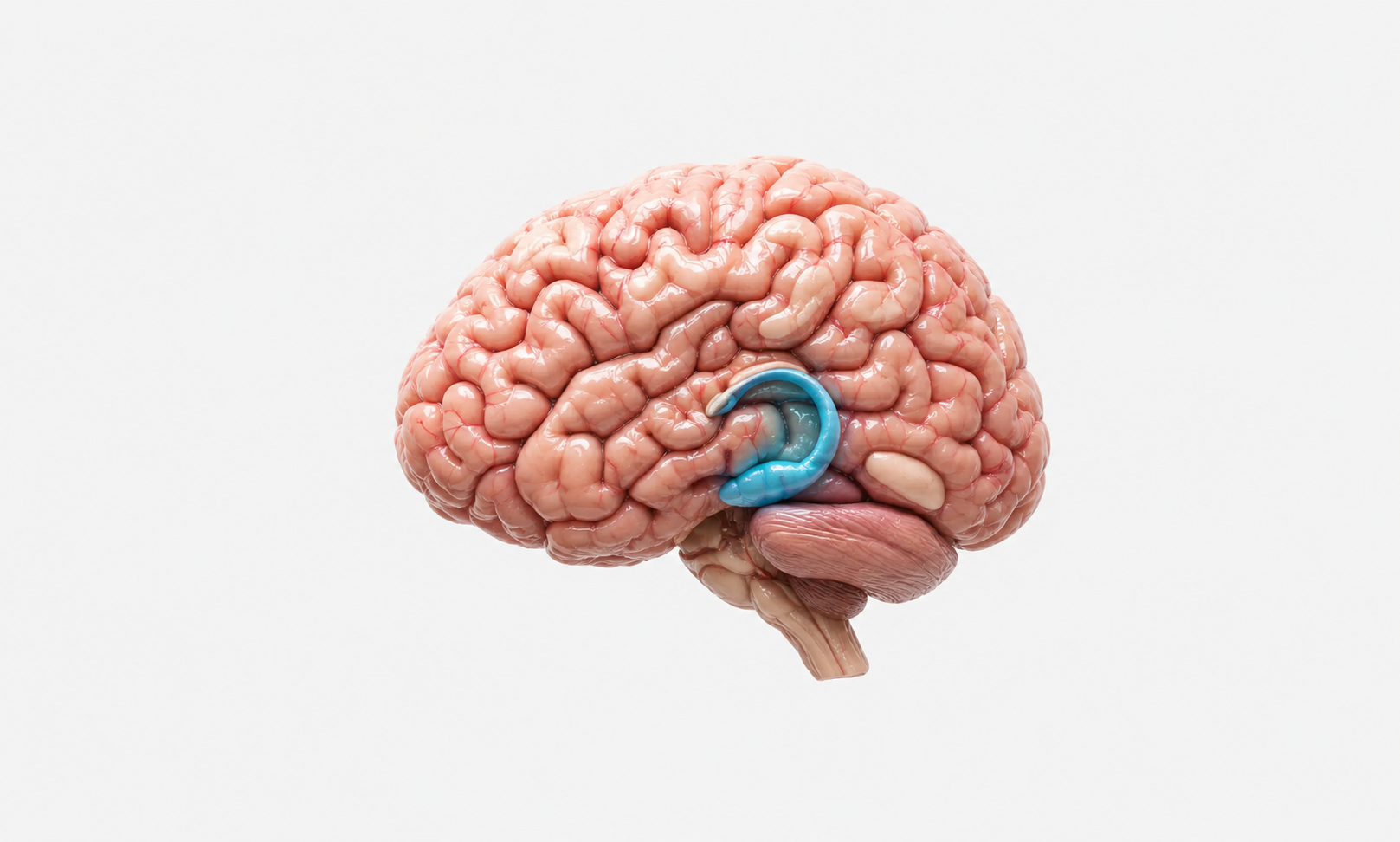Brain image used to locate stress-related regions